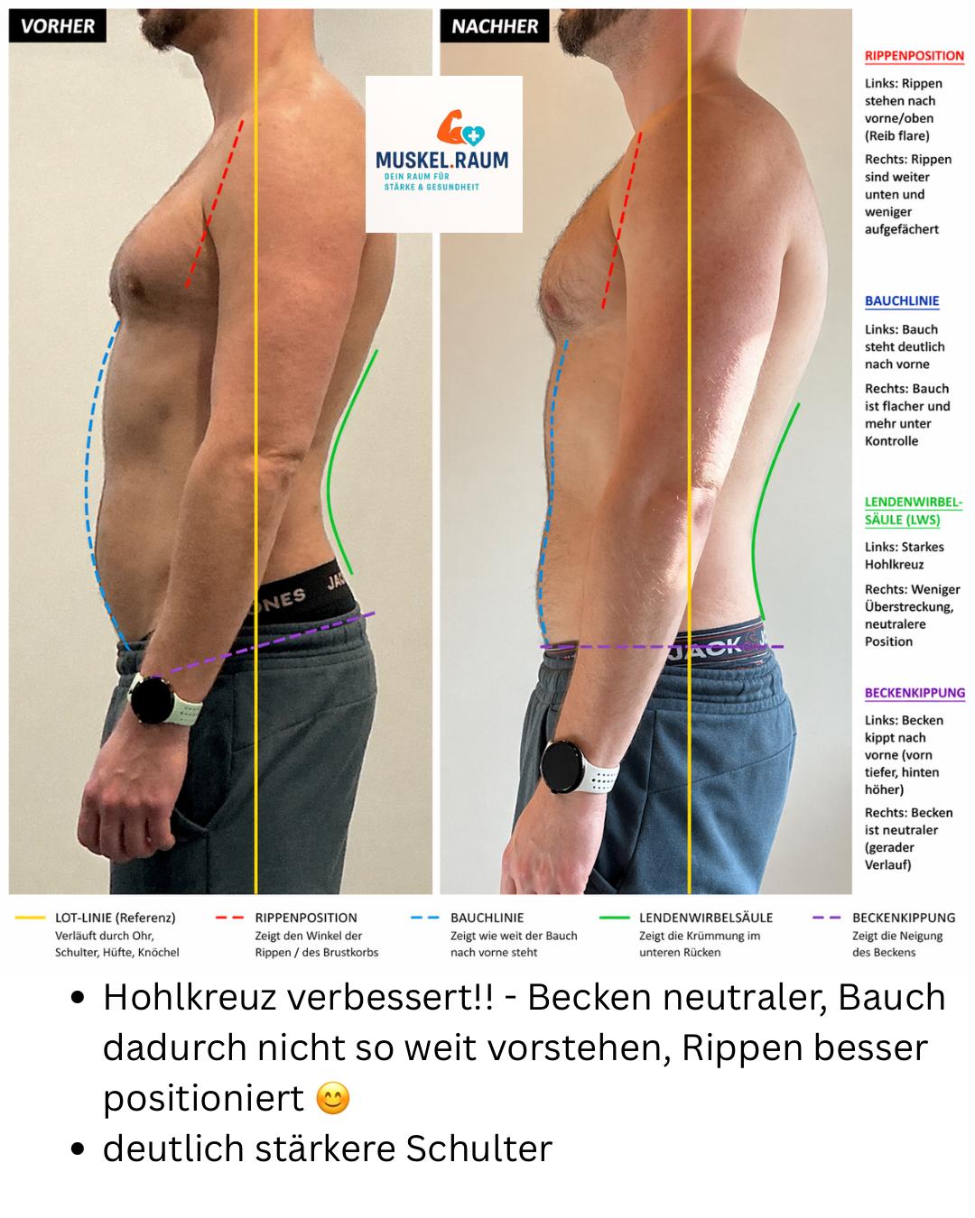 Seitlicher Haltungsvergleich von Jürgen im Verlauf des Personal Trainings bei Muskel.Raum